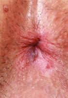Amber showing a lot of her trimmed pussy, Amber Summer (amb070) ATK Petites: Amber Summer (Amber showing a lot of her trimmed pussy)