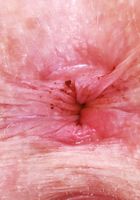 Apricot Pitts Cute Skirt Stripping, Apricot Pitts (apr024) ATK Natural & Hairy: Apricot Pitts (Apricot Pitts Cute Skirt Stripping)