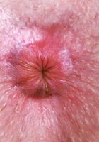 Apricot Pitts from ATK Natural & Hairy