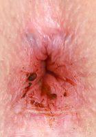Ashley Lane Soiled Panties and Dirty Bum, Ashley Lane (ash074) ATK Galleria: Ashley Lane (Ashley Lane Soiled Panties and Dirty Bum)