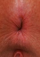 Bess Breast Spreads Her Hairy Pussy, Bess Breast (bes004) ATK Natural & Hairy: Bess Breast (Bess Breast Spreads Her Hairy Pussy)