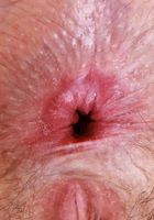 ATK Natural & Hairy: Big Eyes (Big Eyes Says Cover All or Cover None)