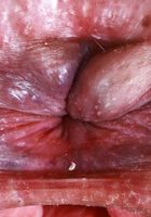 Dria Submits from ATK Natural & Hairy