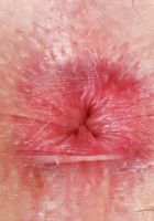 Kate Bloom Takes Her Panties Off, Kate Bloom (kat245) ATK Petites: Kate Bloom (Kate Bloom Takes Her Panties Off)