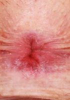 Nova Vixen Outdoor Nudes, Nova Vixen (nov003) ATK Galleria: Nova Vixen (Nova Vixen Outdoor Nudes)