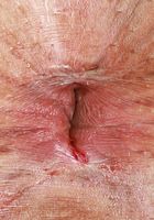 Penelope Reed Outdoor Spreads, Penelope Reed (pen027) ATK Exotics: Penelope Reed (Penelope Reed Outdoor Spreads)